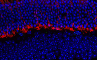 Con Instituto di Neuroscienze del CNR Una Rosa per la vista, una rosa per la vita